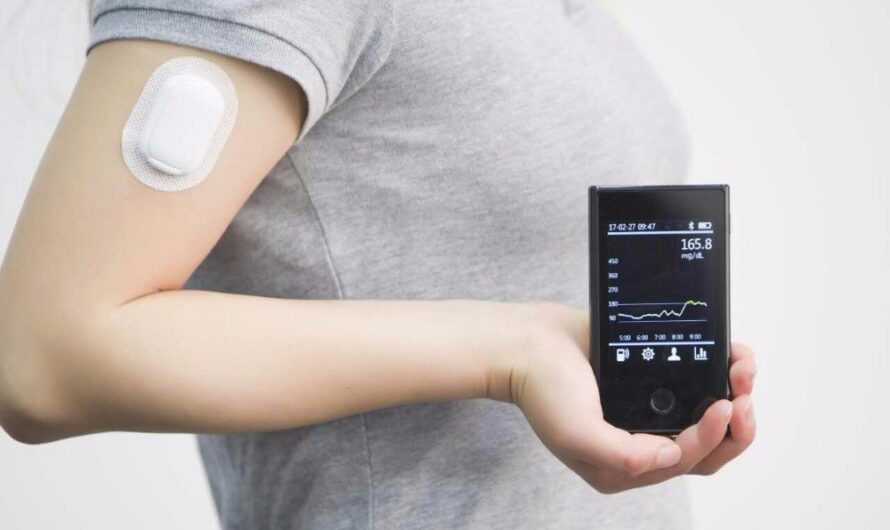Continuous Glucose Monitoring Devices Market: Rising Prevalence of Diabetes to Drive Market Growth