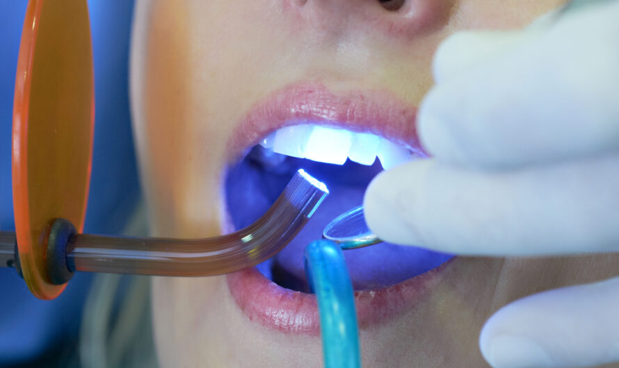 Dental Polymerization Lamps Market: Growing Demand for Dental Treatment Drives Market Growth