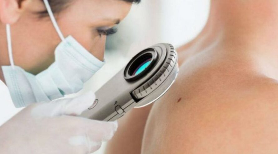 Software Automation Is The Fastest Growing Segment Fueling Growth Of The Dermatoscope Market