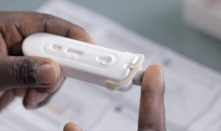 HIV Diagnostics Test Market