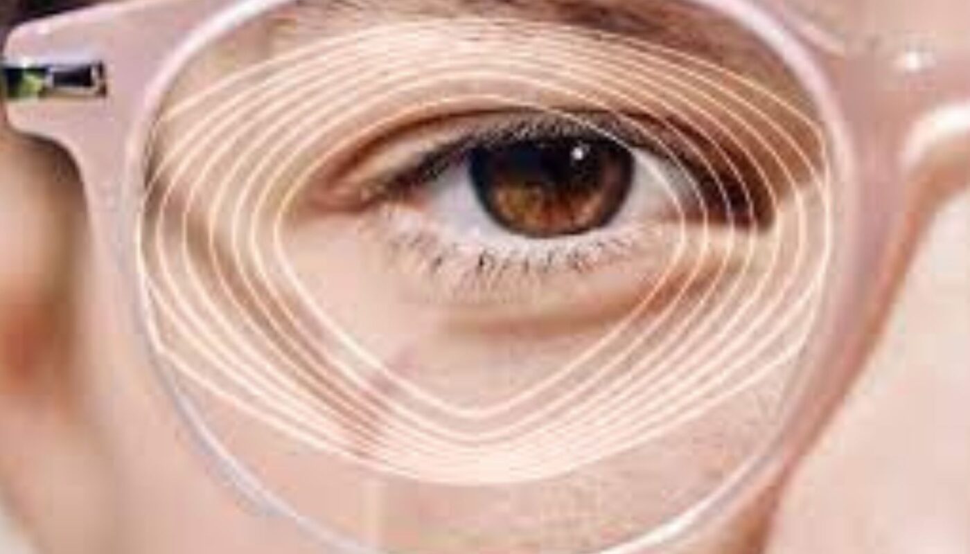 Myopia Control Lenses Market