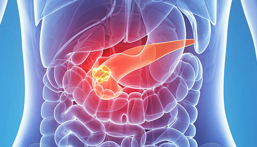The Neuroendocrine Tumor Treatment Market is projected to driven by rising cancer prevalence