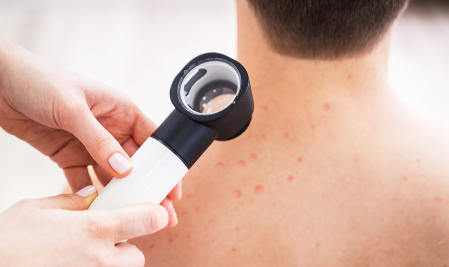 The Global Dermatoscope Market Is Estimated To Propelled By Surging Demand For Skin Cancer Diagnosis And Treatment