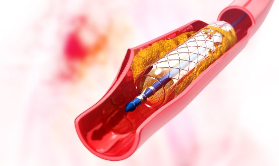 The Global India Coronary Stents Market Is Estimated To Propelled By Rising Cases Of Cardiovascular Diseases