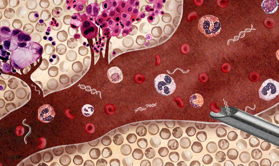 Biomarkers in Blood: Paving the Path to Precision Medicine for Disease Diagnosis and Prognosis