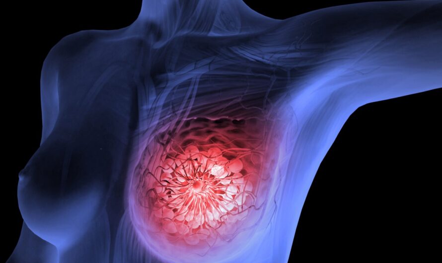 Insightful Innovations: Navigating Breast Health Through Imaging