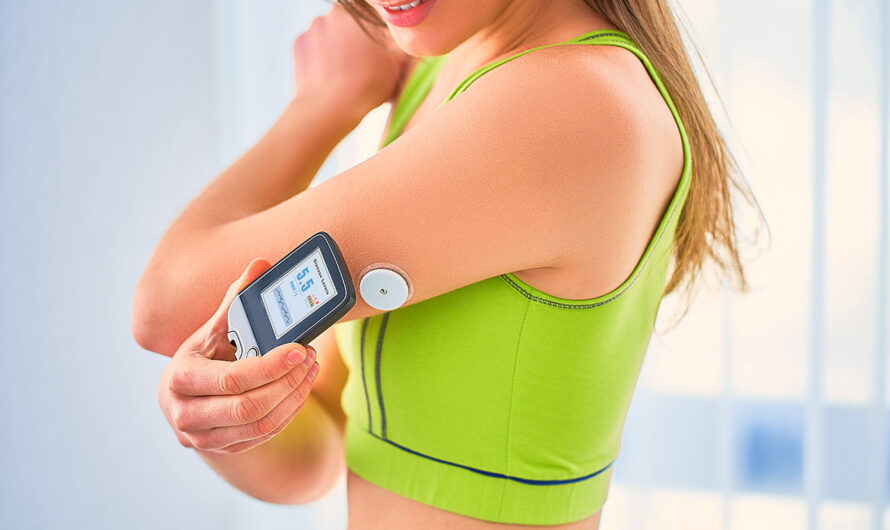 Continuous Glucose Monitoring Devices Market is trending towards remote monitoring solutions