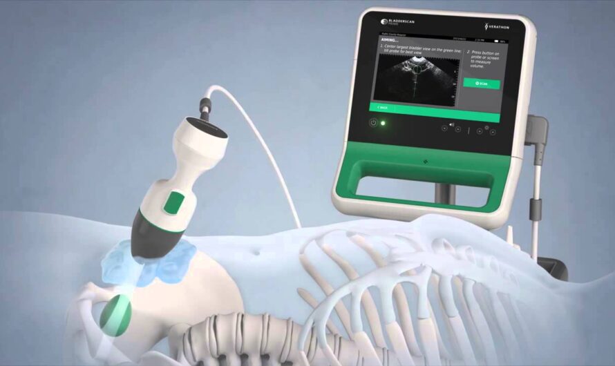 Revolutionizing Healthcare: The Power of Portable Ultrasound Bladder Scanners
