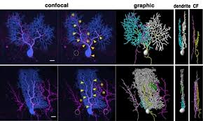 Comparing Purkinje Cells in Humans and Mice to Gain Insight into Brain Complexity