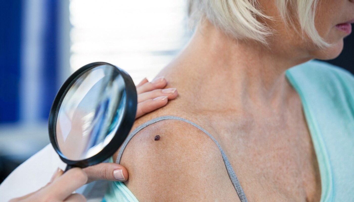 Unveiling the Mystery Behind Melanoma Resistance to Targeted Therapies