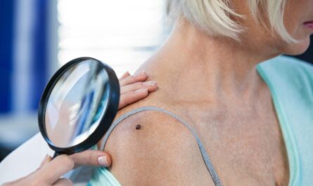 Unveiling the Mystery Behind Melanoma Resistance to Targeted Therapies